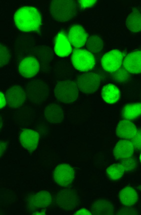 Microscopy image of a T-cell population harboring a shortened form of the HIV virus that expresses a green fluorescent protein. Different drug treatments result in the various amounts of cell-to-cell variability in gene expression.